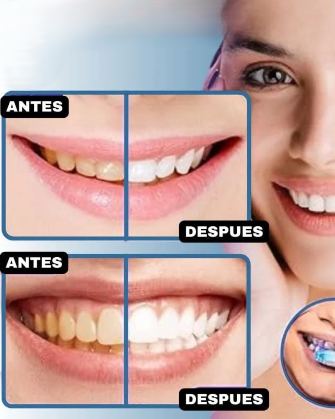 CREMA BLANQUEADORA HISMILEV34