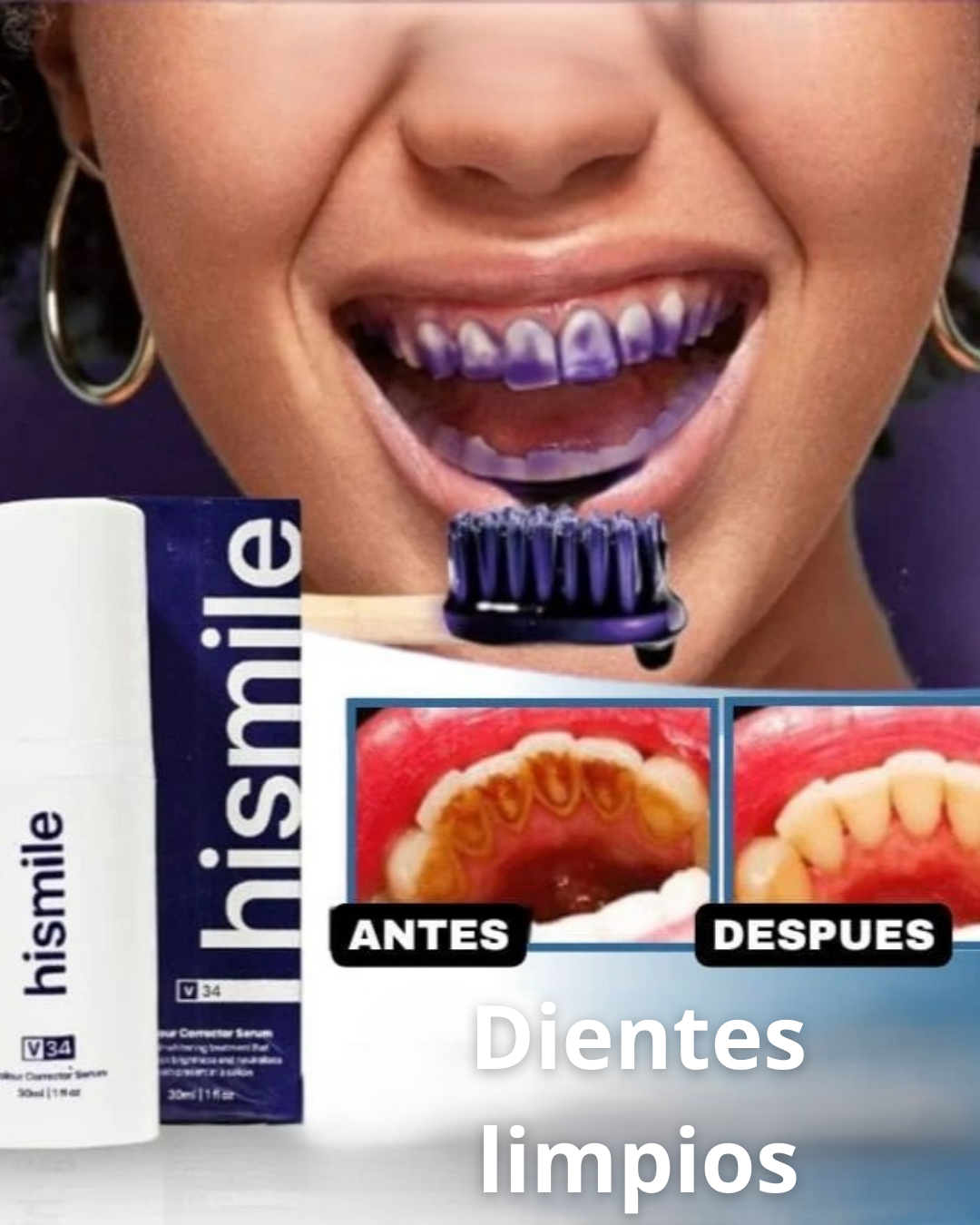 CREMA BLANQUEADORA HISMILEV34